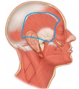 側頭筋　たるみ　ほうれい線　浮腫み